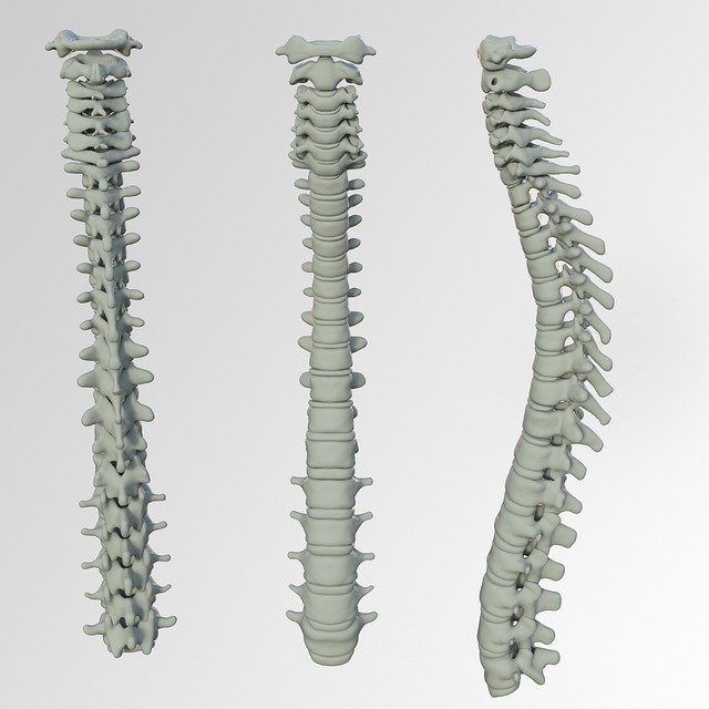 소화불량 원인
2. 척추 변형
척추, spine