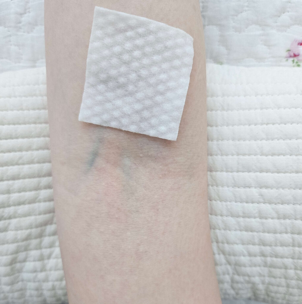 실제 팔의 정맥
