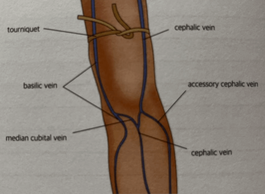 팔에 분포한 정맥