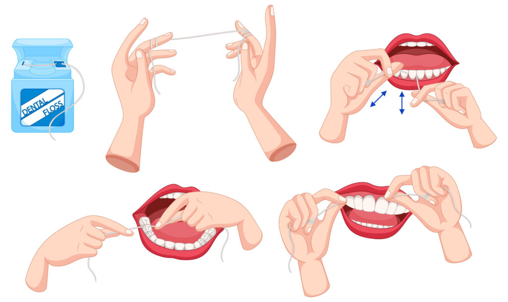 올바른 치실 사용법