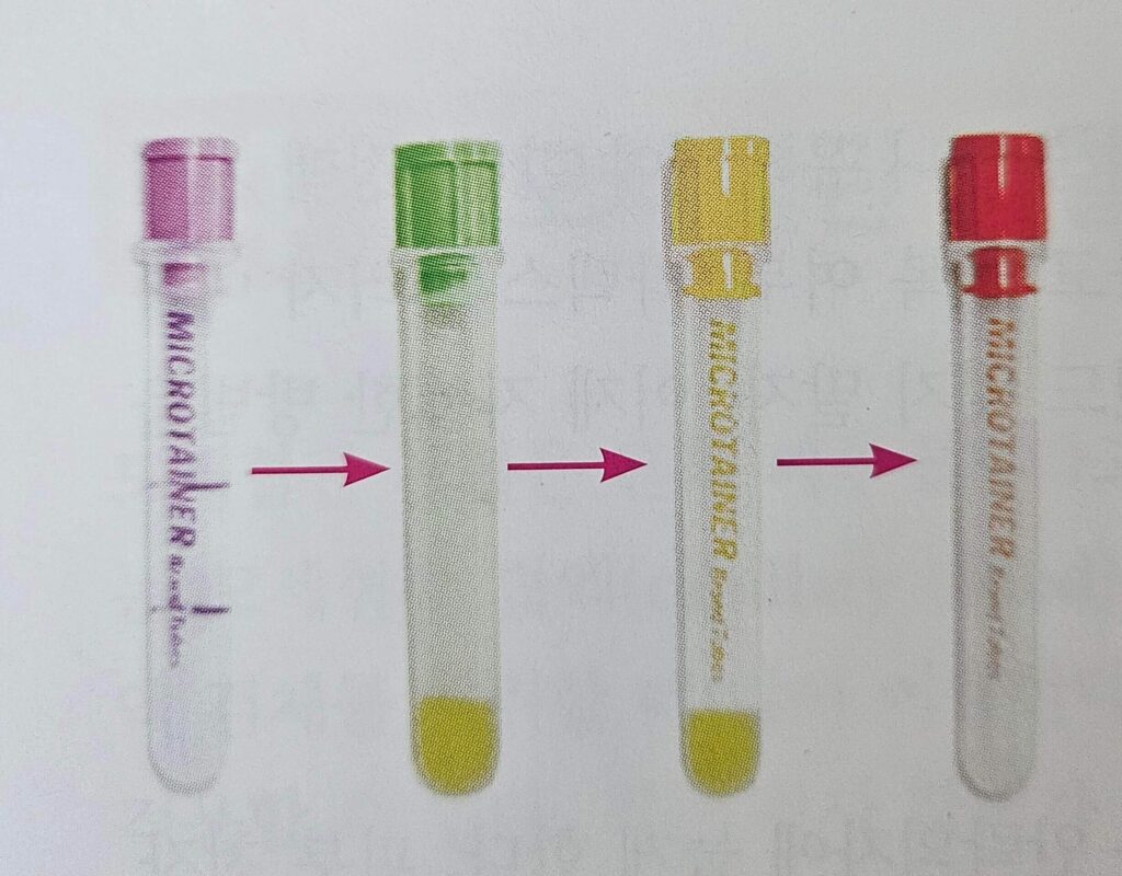 모세혈관 채혈 - 마이크로 튜브 채혈 순서